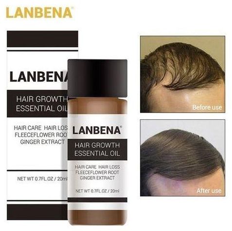 Lanbena Hair Growth Essence Oil price from jumia in Nigeria - Yaoota!