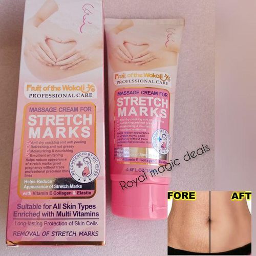 Beauty Guaranteed Stretch Marks Removal Cream For After Birth