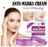 White Gold Anti-Marks & Extra Brightening Cream