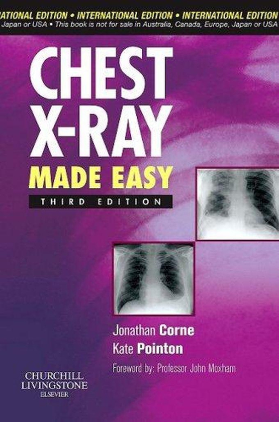 Chest X-Ray Made Easy ,Ed. :3