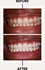 Dr. Rashel Teeth Whitening Toothpaste Coffee Tea Cigarette Stains