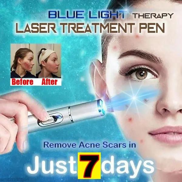 Updated Medical Blue Light Therapy Varicose Veins Soft Scar Wrinkle Removal Treatment Laser Pen