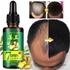 Clothes Of Skin Anti Hair Loss 7days Oil Treatment Hair Growth Essence