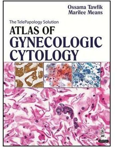 Generic Atlas of Gynecologic Cytology by Ossama Tawfik - Hardcover