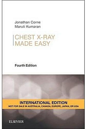 Chest X-Ray Made Easy ,Ed. :4
