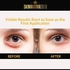 Puffy Eyes Treatment Serum- Anti Aging Under Eye Cream Formula for Puffiness, Dark Circles, Fine Lines, Wrinkles & Under Eye Bags with Hyaluronic Acid & Vitamin C. Instant Results within Minutes.