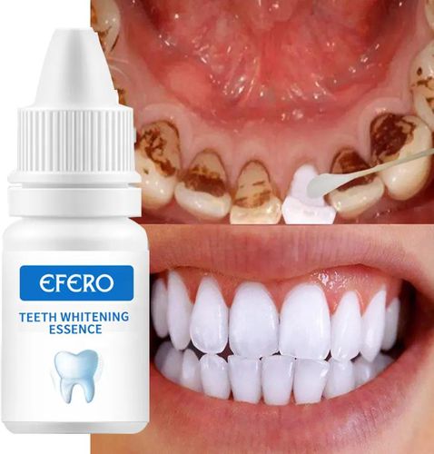 Teeth Whitener  teeth whitening essence, EFERO professional easy white teeth whitening essence liquid