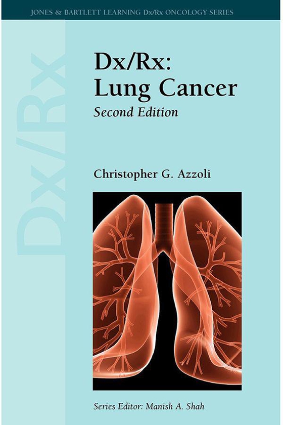 Dx/Rx: Lung Cancer by Christopher G. Azzoli - Paperback