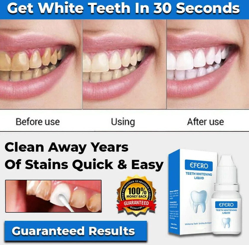 Teeth Whitening Teeth Whitener Stains Remover - Efero-