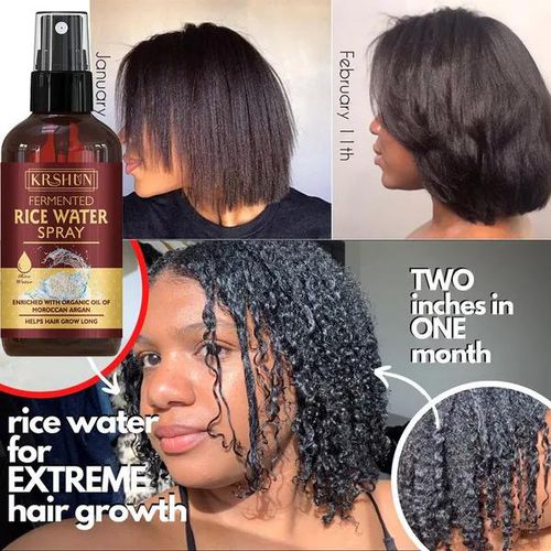 2021!new!30ml Rice Hair Growth Spray Anti Hair Loss Treatment Serum Fast  Growth Longer Thicker Hair for Men Women price from kilimall in Kenya -  Yaoota!