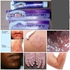 Neutrobact Neutrobact Cream For Skin Nanuum , Diaper Rash, Eczema