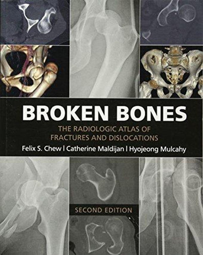 Cambridge University Press Broken Bones: The Radiologic Atlas of Fractures and Dislocations ,Ed. :2