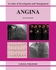 Angina: An Atlas of Investigation and Management ,Ed. :1