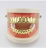 Gold-Plated Top Bottom Eight Teeth Set
