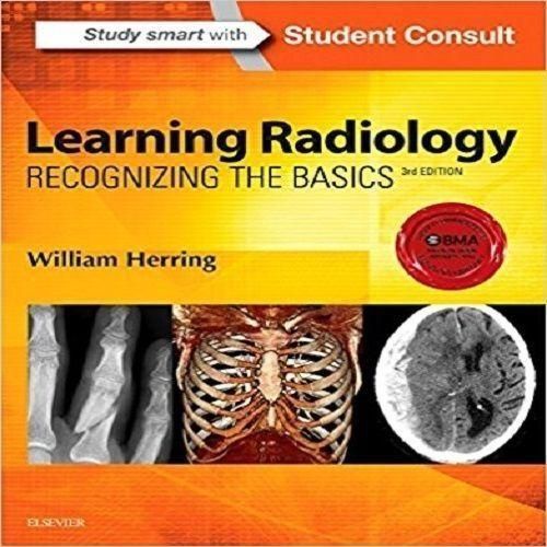 Jumia Books Learning Radiology: Recognizing The Basics, 3e 3rd Edition