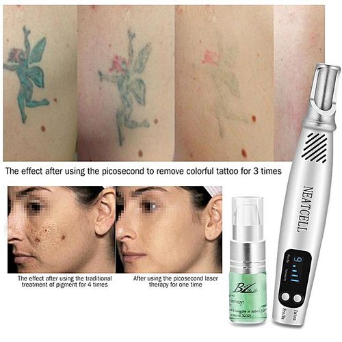 Generic Mole Freckle Removal Machine Tattoo Scar Remover Picosecond Laser  Pen Device + Repair Gel price from jumia in Nigeria - Yaoota!