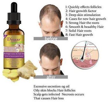 Disaar Stimulate Hair Growth Stop Baldness, Hair Loss price from jumia in  Kenya - Yaoota!