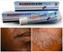 Generic Quadriclear Cream For Eczema, Dermatitis And Rashes