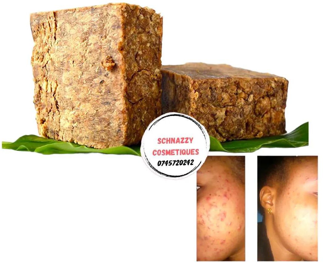 Ghana West Africa Black Soap Raw Organic African Black Soap: Fights Multiple Skin Conditions 100% Vegan Base