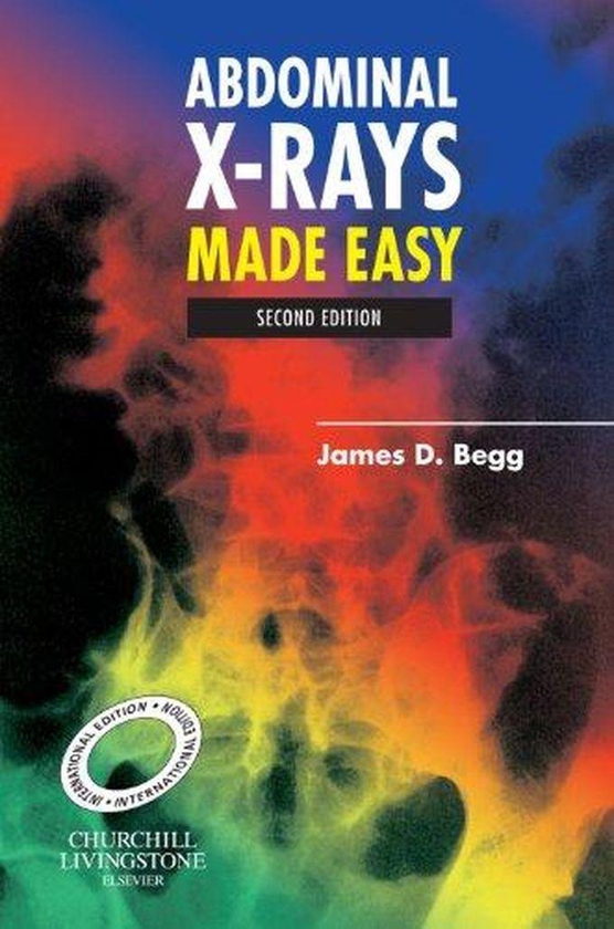 Abdominal X-Rays Made Easy ,Ed. :2
