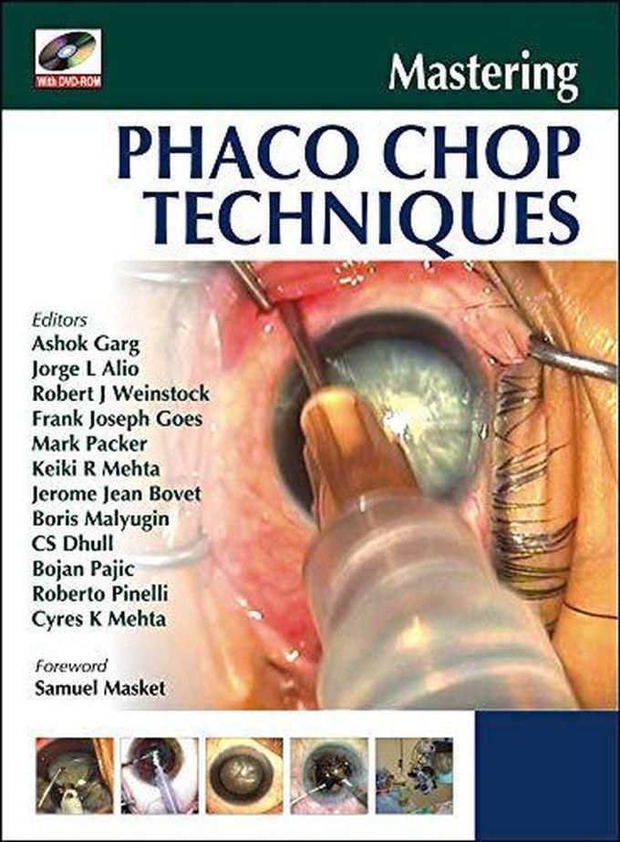 Mcgraw Hill Mastering Phaco Chop Techniques ,Ed. :1