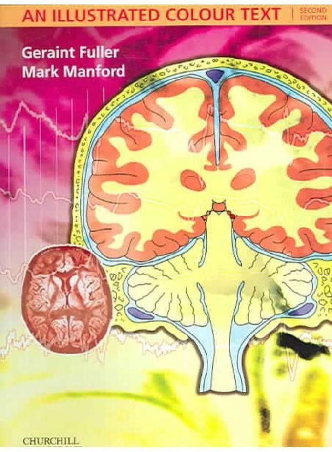 Neurology: An Illustrated Colour Text ,Ed. :2