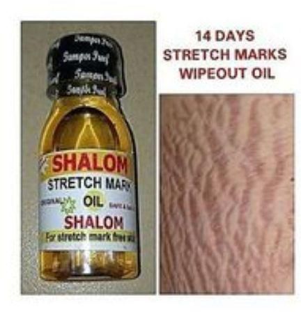 Shalom 14 Days Quick Action Stretch Marks Wipeout Oil