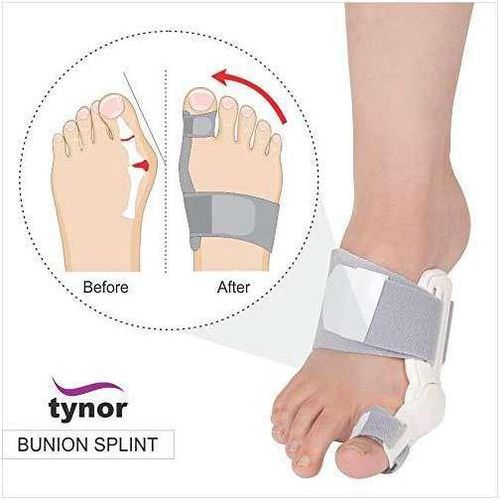 Tynor Bunion Splint