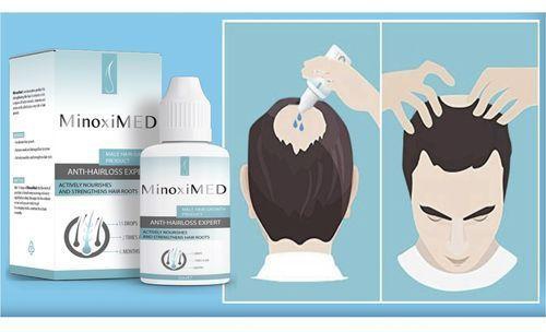 MinoxiMED Your Hair Growth Solution - Restore Hair in Baldness
