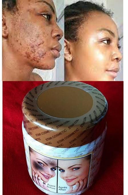 Star Skin Repair Corrector Cream With Argan Oil & Shea Butter