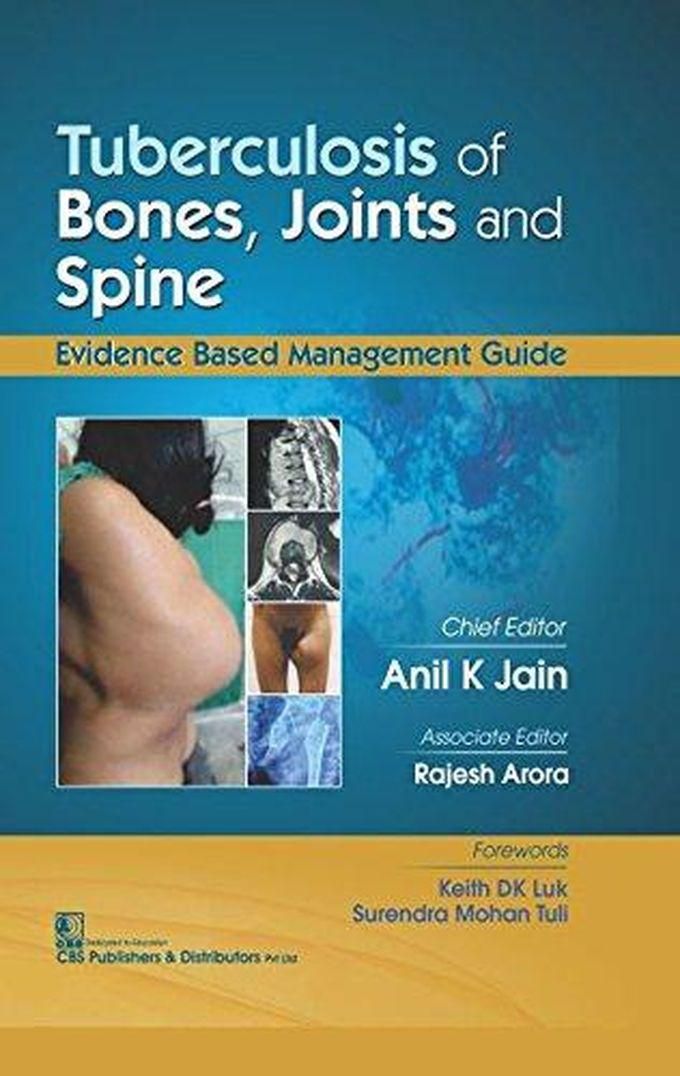 Tuberculosis Of Bones Joints And Spice,India