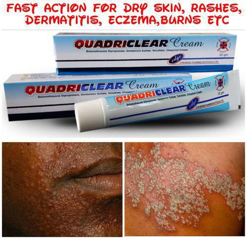 eczema treatment cream in nigeria)