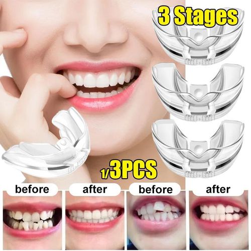 3Stages Tooth Orthodontic Trainer Dental Tooth Appliance Alignment Brace Silicone Guard TeethStraightener Tooth Tray Oral Hygiene
