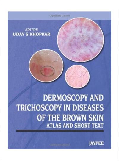 Dermoscopy And Trichoscopy In Diseases Of The Brown Skin Atlas And Short Text Paperback 1