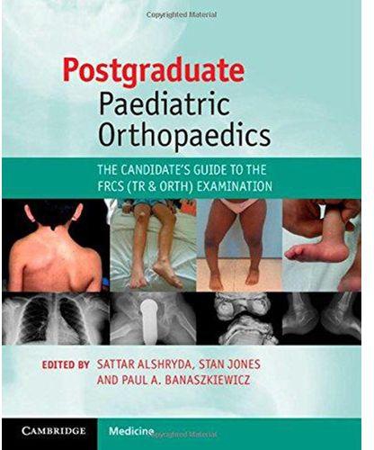 Postgraduate Paediatric Orthopaedics : The Candidate's Guide to the FRCS (Tr & Orth) Examination