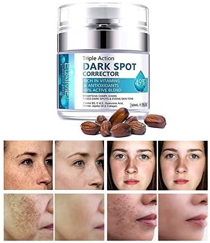 SWETIYOU Dark Spot Remover for Face, Fast-Acting Dark Spot Corrector Remover for Face and body Hyperpigmentation, Fades Melasma, Freckle, Sun Spots, Evens Skin Tone, Age Spot Remover for Women Men