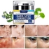 Dark Spot Remover for Face Hyperpigmentation Treatment. Dark Spots, Melasma, Freckle, Sun Spots Removal Dark Spot Corrector Cream for Women and Men