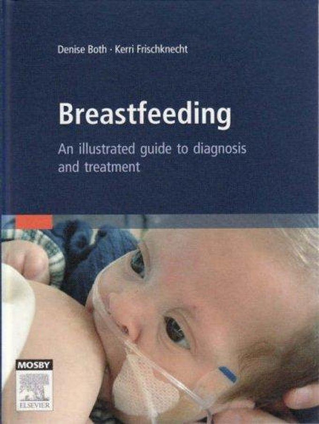 Breastfeeding: An Illustrated Guide To Diagnosis and Treatment ,Ed. :1