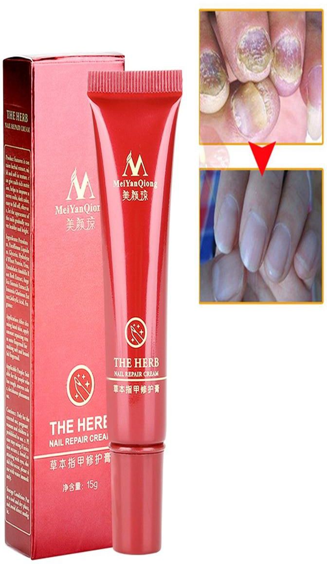 MeiYanQiong The Herb Nail Repair Cream 15 g price from jollychic in Saudi  Arabia - Yaoota!