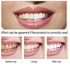 Teeth Whitening Teeth Whitener Fast Acting Teeth Whitening Yellow Teeth Stains Remover Teeth Whitener
