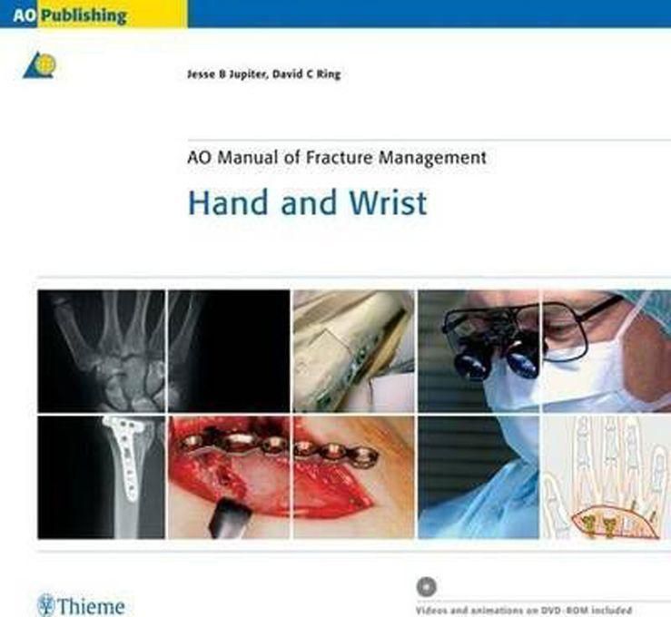 Hand and Wrist : AO Manual of Fracture Management