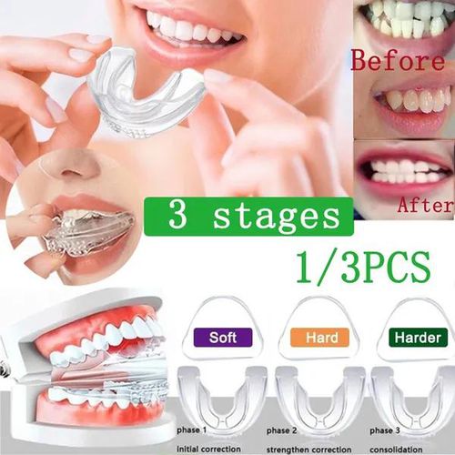 Adults Orthodontic Trainer Dental Tooth Appliance Alignment Brace for Teeth Grinding