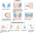 Adhesive Silicone Reusable Strapless Invisible Push-up Bra - Size C