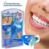 WhiteLight Teeth Whitening Kit