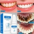 Teeth Whitener Fast Acting Teeth Whitening Yellow Teeth Stains Remover Teeth Whitener