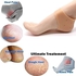 heel anti set for women Shock,gel,Protector Socks Foot Protector Silicon Toe Free Heel Pain Relief Socks For Men And Women