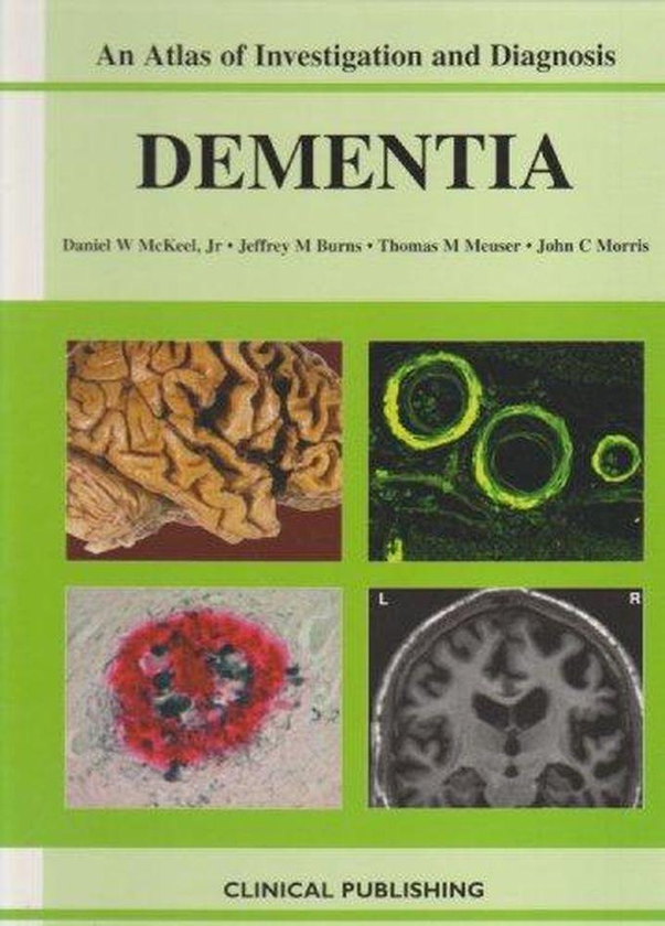 An Atlas of Investigation and Diagnosis Dementia