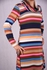 Striped Tunic Top - Pink