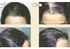 Faster Advance Oil Hair Back - For Women - 100 Ml - 1pcs
